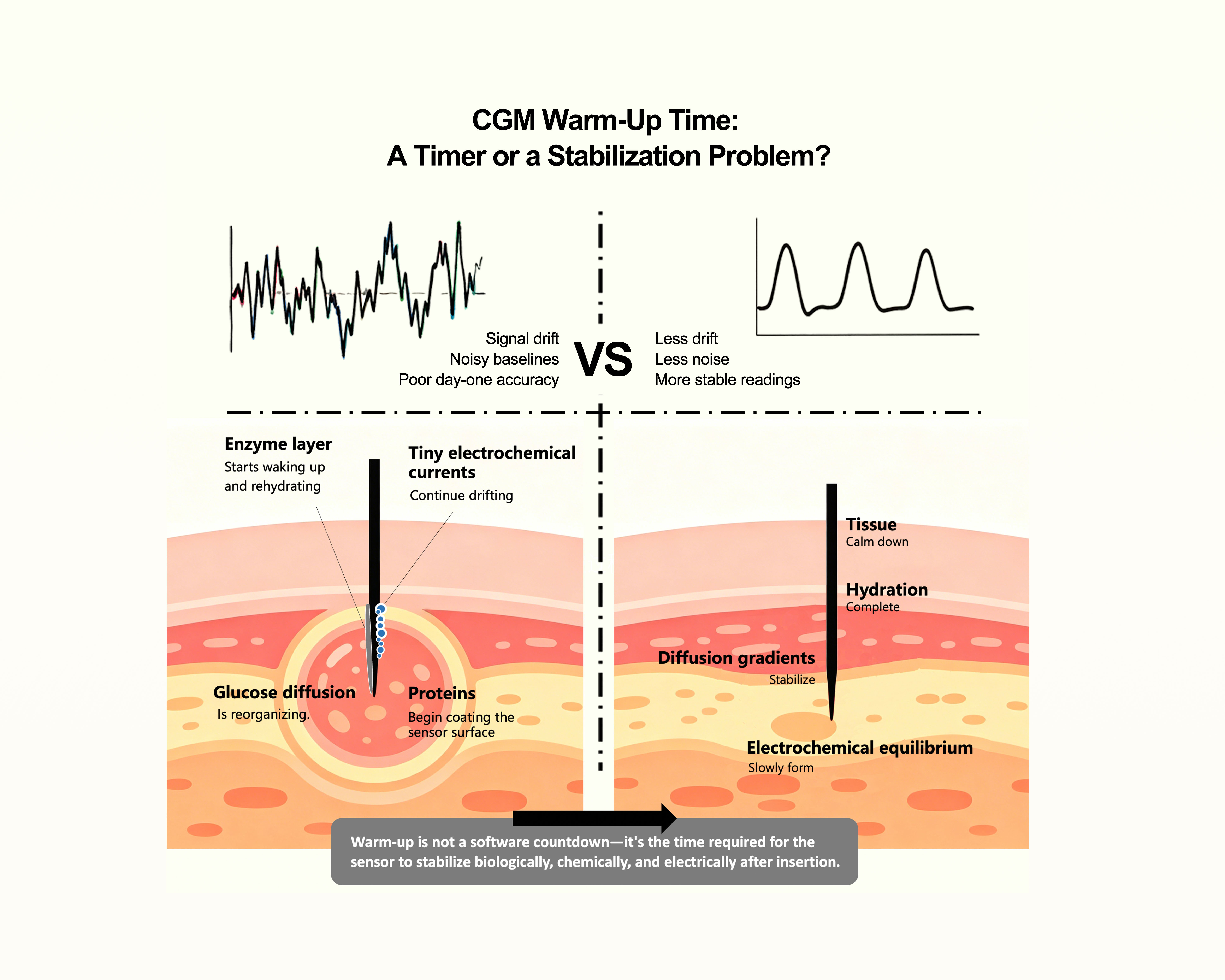 cgm warm up time stabilization 1